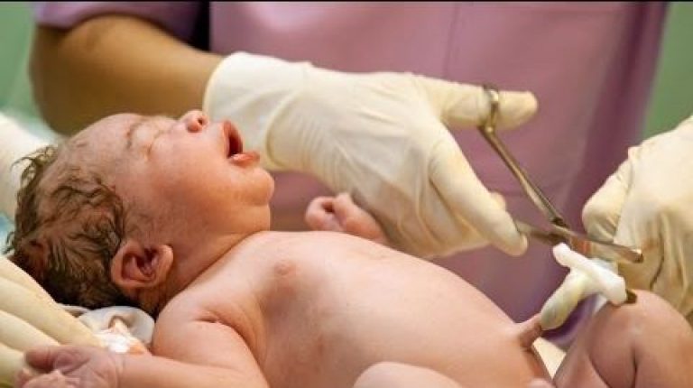 optimal-cord-clamping-birthwell-birthright